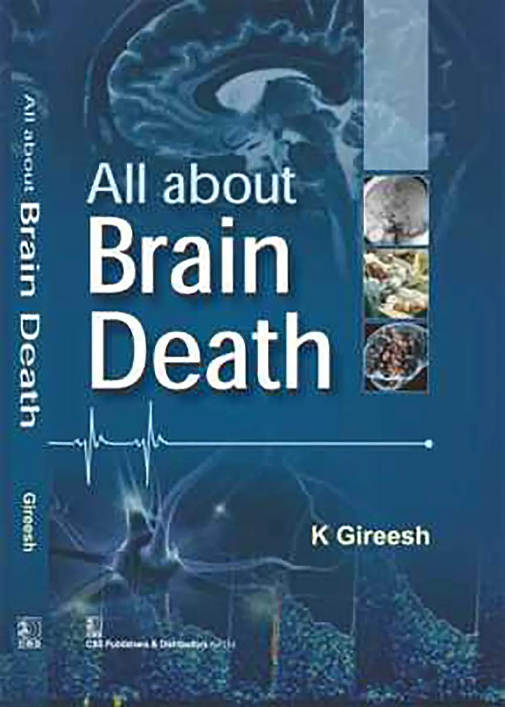 All about Brain Death | Hardcover