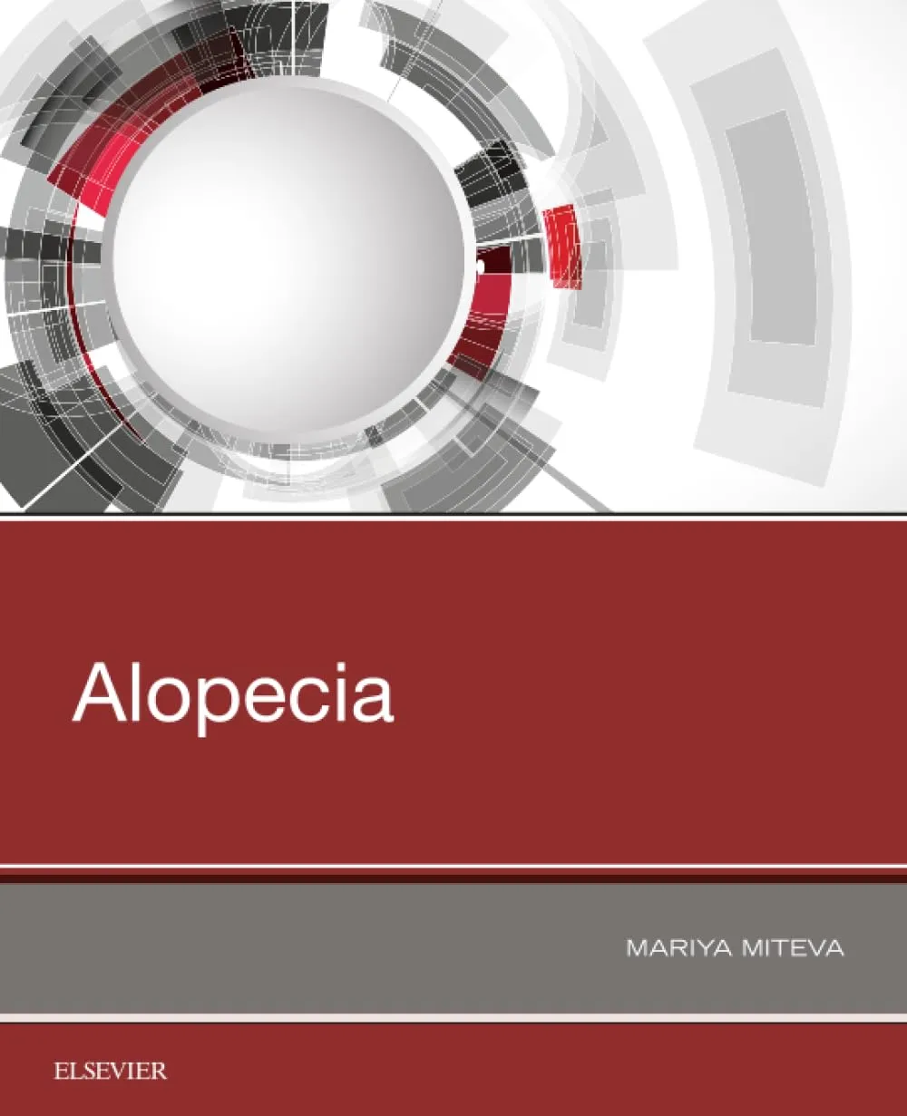 Alopecia | Paperback