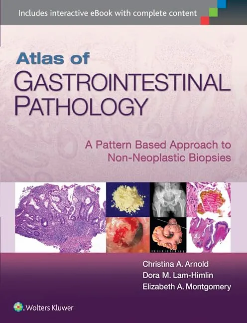 Altas of Gastrointestinal Pathology A Pattern Based Approach To Non Neoplastic Biopsies | Hardcover