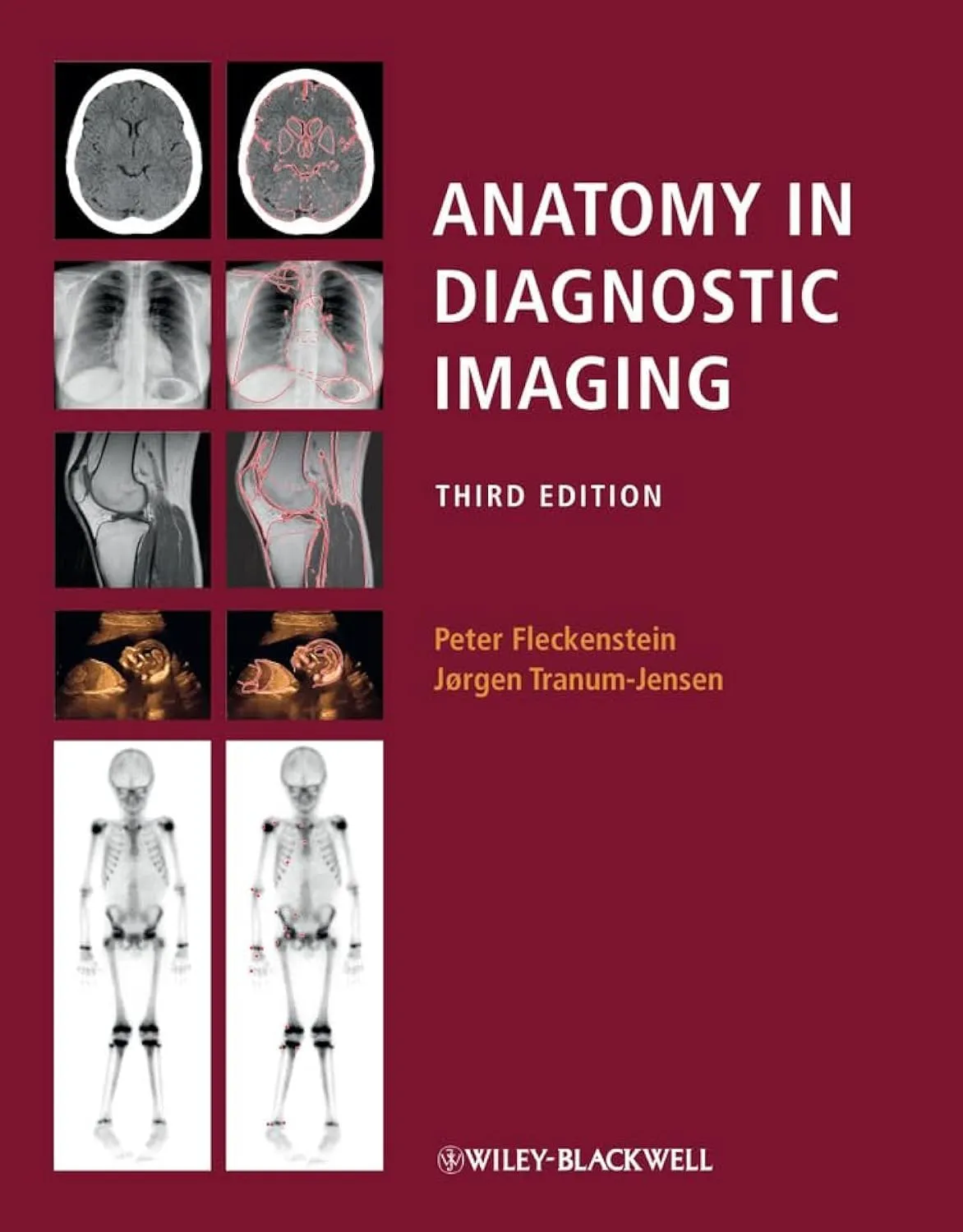 Anatomy in Diagnostic Imaging | Third Edition Original Price $97.95 | Paperback