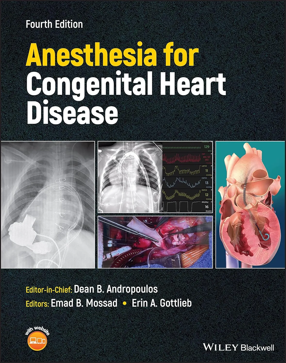 Anesthesia For Congenital Heart Disease 4th Edition | Hardcover