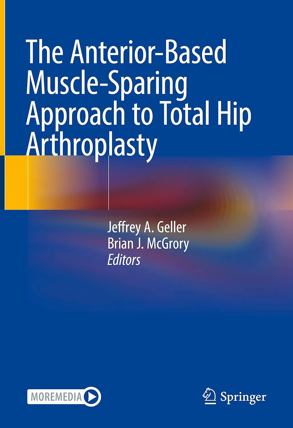 The Anterior Based Muscle Sparing Approach To Total Hip Arthroplasty | Hardcover