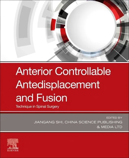 Anterior Controllable Antedisplacement And Fusion Technique In Spinal Surgery | Paperback