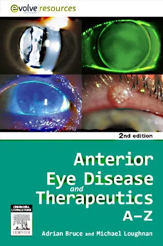 Anterior Eye Disease and Therapeutics A-Z | 2nd Edition | Paperback