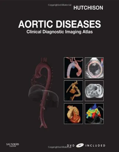 Aortic Diseases Clinical Diagnostic Imaging Atlas | With DVD | Hardcover