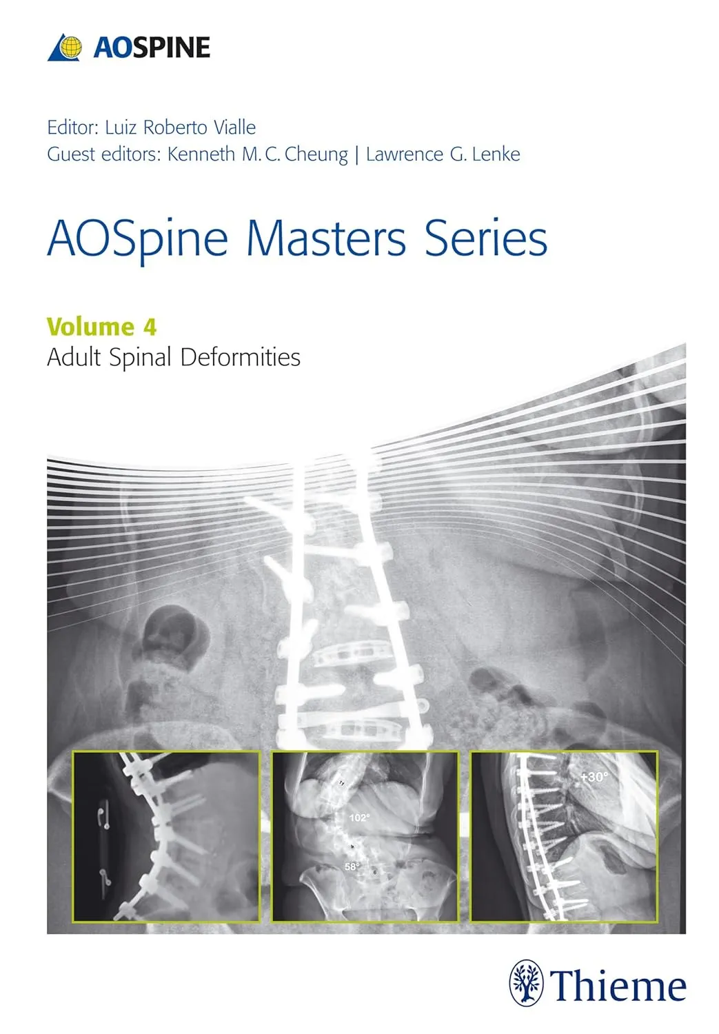 AOSpine Masters Series Adult Spinal Deformities | Volume 4 | Hardcover