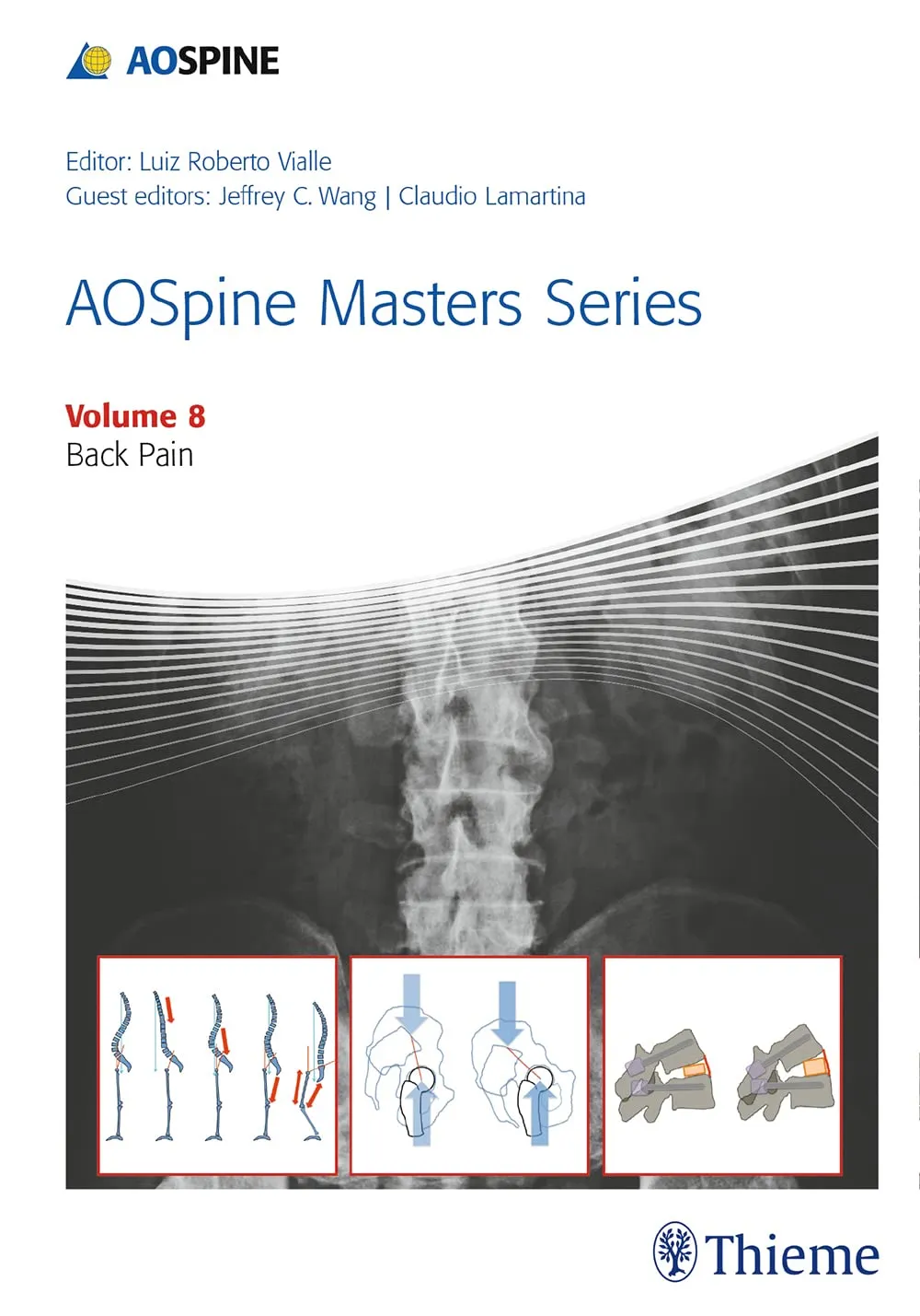 AOSpine Masters Series Back Pain | Volume 8 | Hardcover
