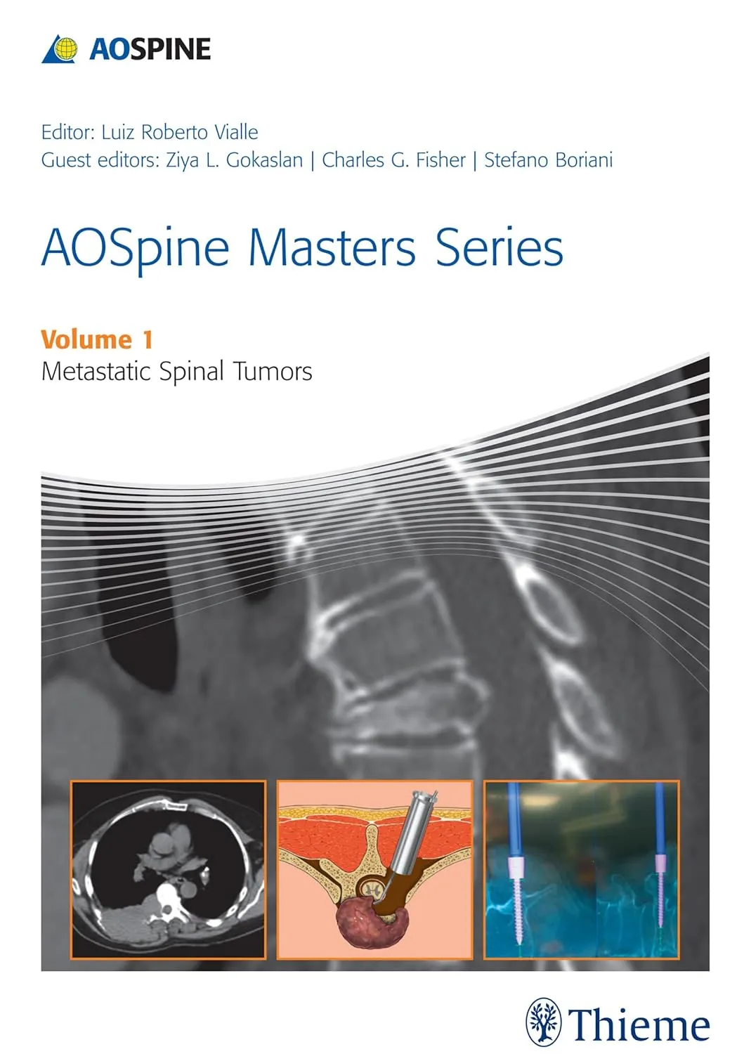 AOSpine Masters Series Metastatic Spinal Tumors | Volume 1 | Hardcover