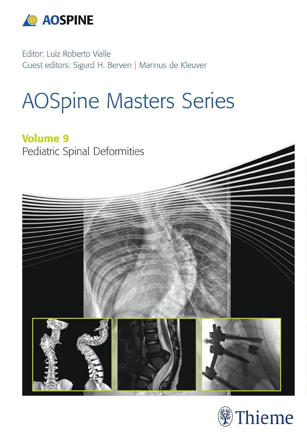 AOSpine Masters Series Pediatric Spinal Deformities | Volume 9 | Hardcover