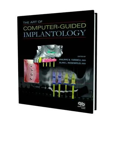The Art of Computer-Guided Implantology | Hardcover