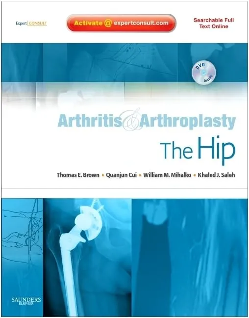 Arthritis and Arthoplasty The Hip With DVD | Hardcover