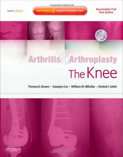 Arthritis and Arthoplasty The Knee With DVD | Hardcover