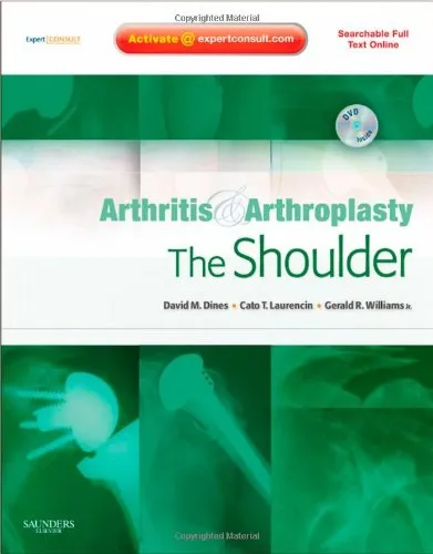 Arthritis and Arthoplasty The Shoulder With DVD | Hardcover