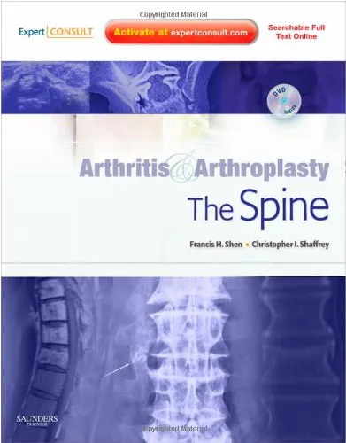 Arthritis and Arthroplasty The Spine | With DVD | Hardcover