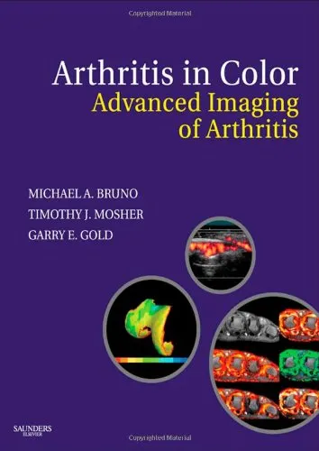 Arthritis in Color Advanced Imaging of Arthritis | Hardcover