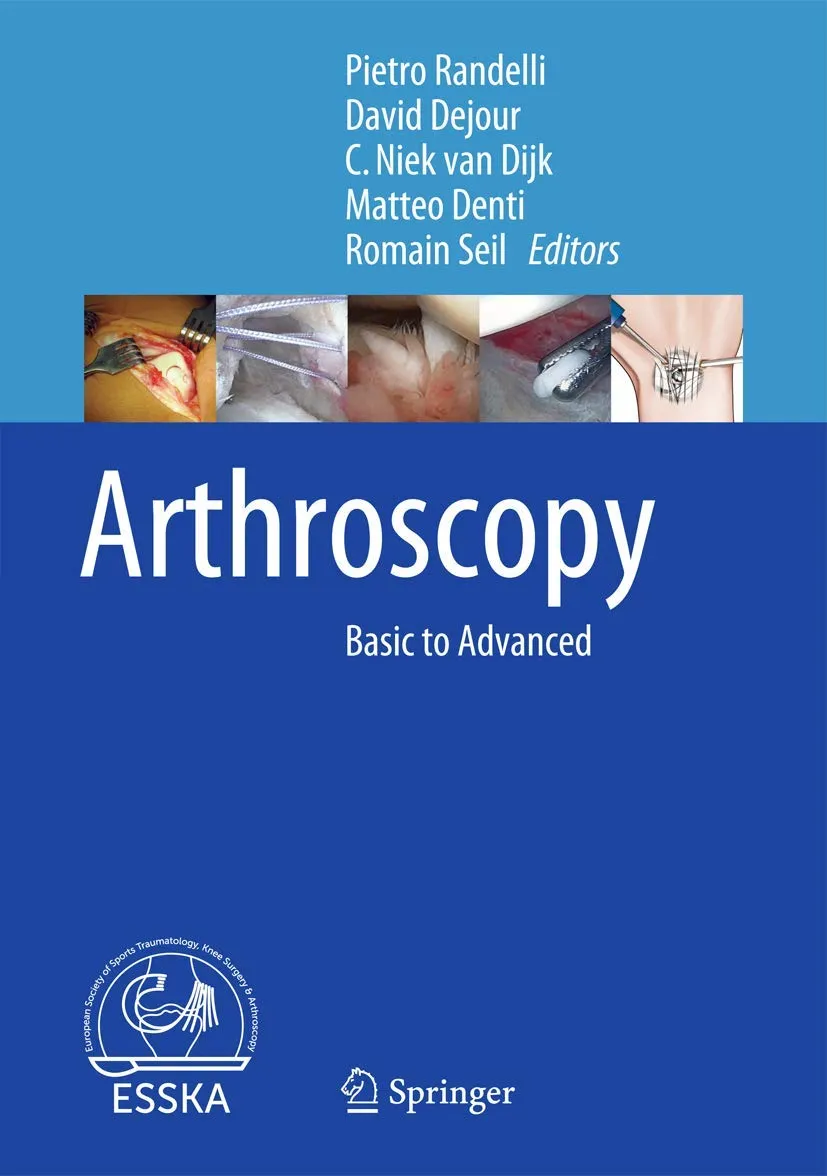Arthroscopy | Hardcover