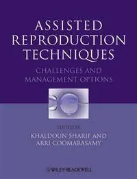 Assisted Reproduction Techniques Challenges and Mamangement Options | Hardcover