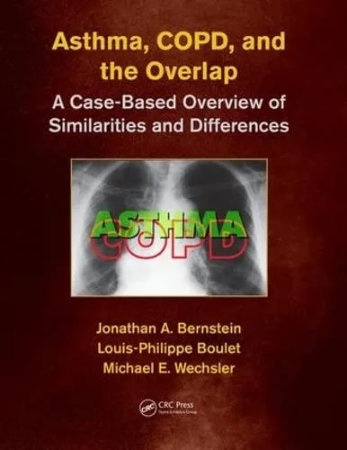 Asthma | COPD | and Overlap A Case-Based Overview of Similarities and Differences | Paperback