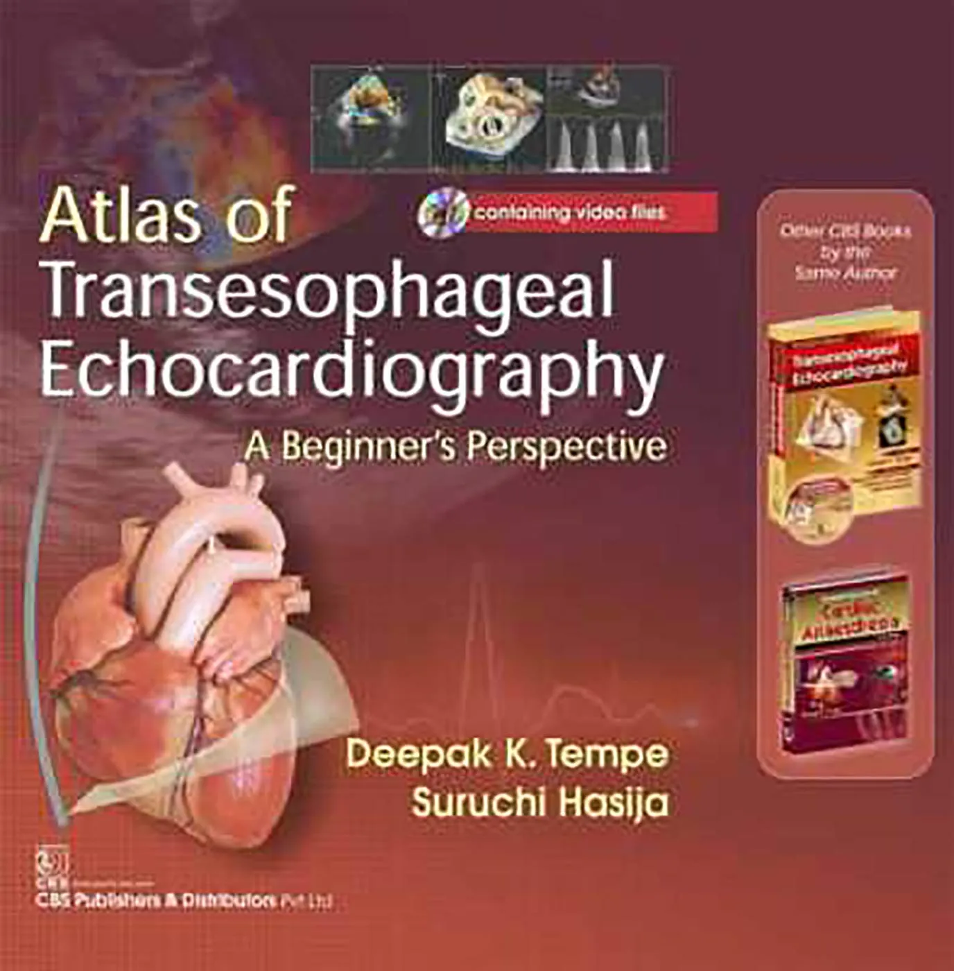 Atals of Transesophageal Echocardiography A Beginners Perspective (Included CD Containing Video Files) | Hardcover