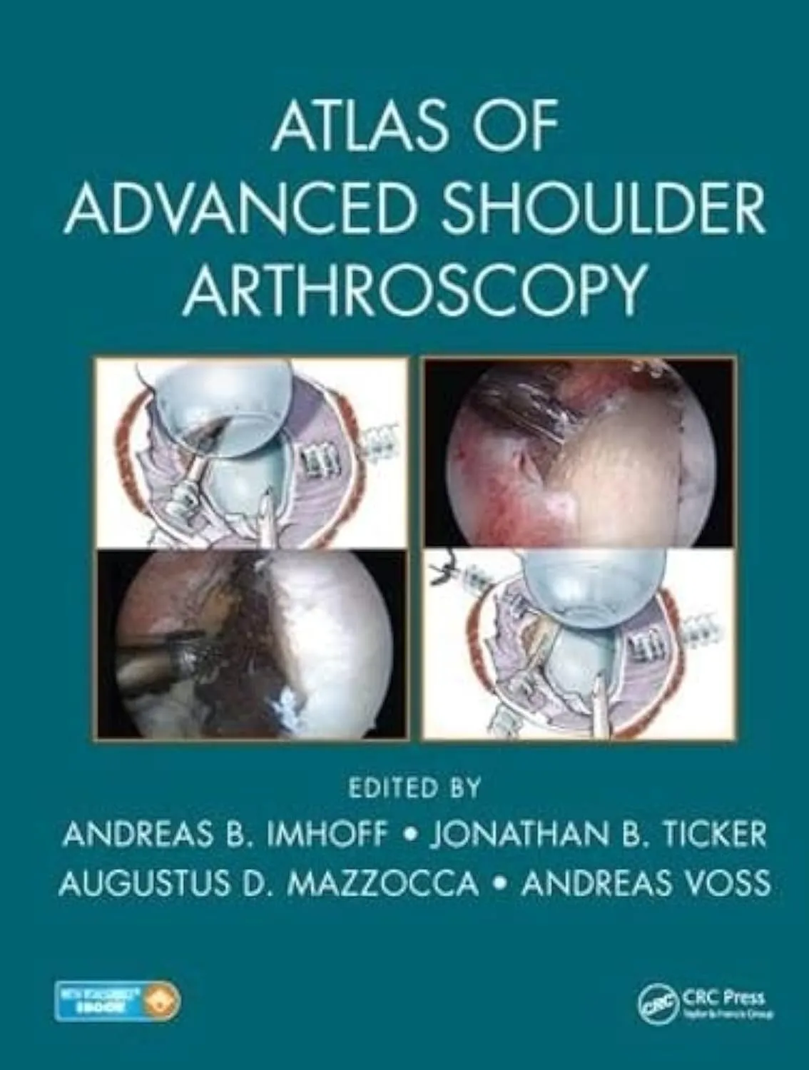 Atlas of Advanced Shoulder Arthroscopy | Hardcover