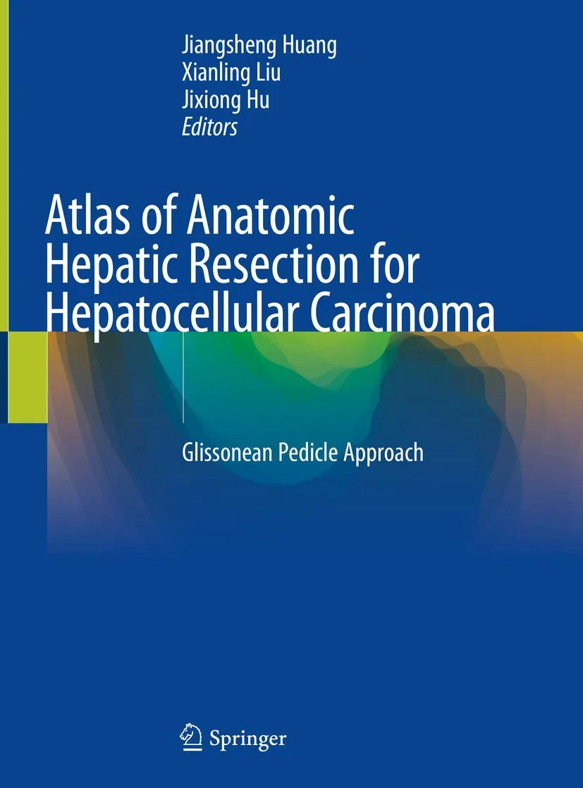 Atlas of Anatomic Hepatic Resection for Hepatocellular Carcinoma | Hardcover