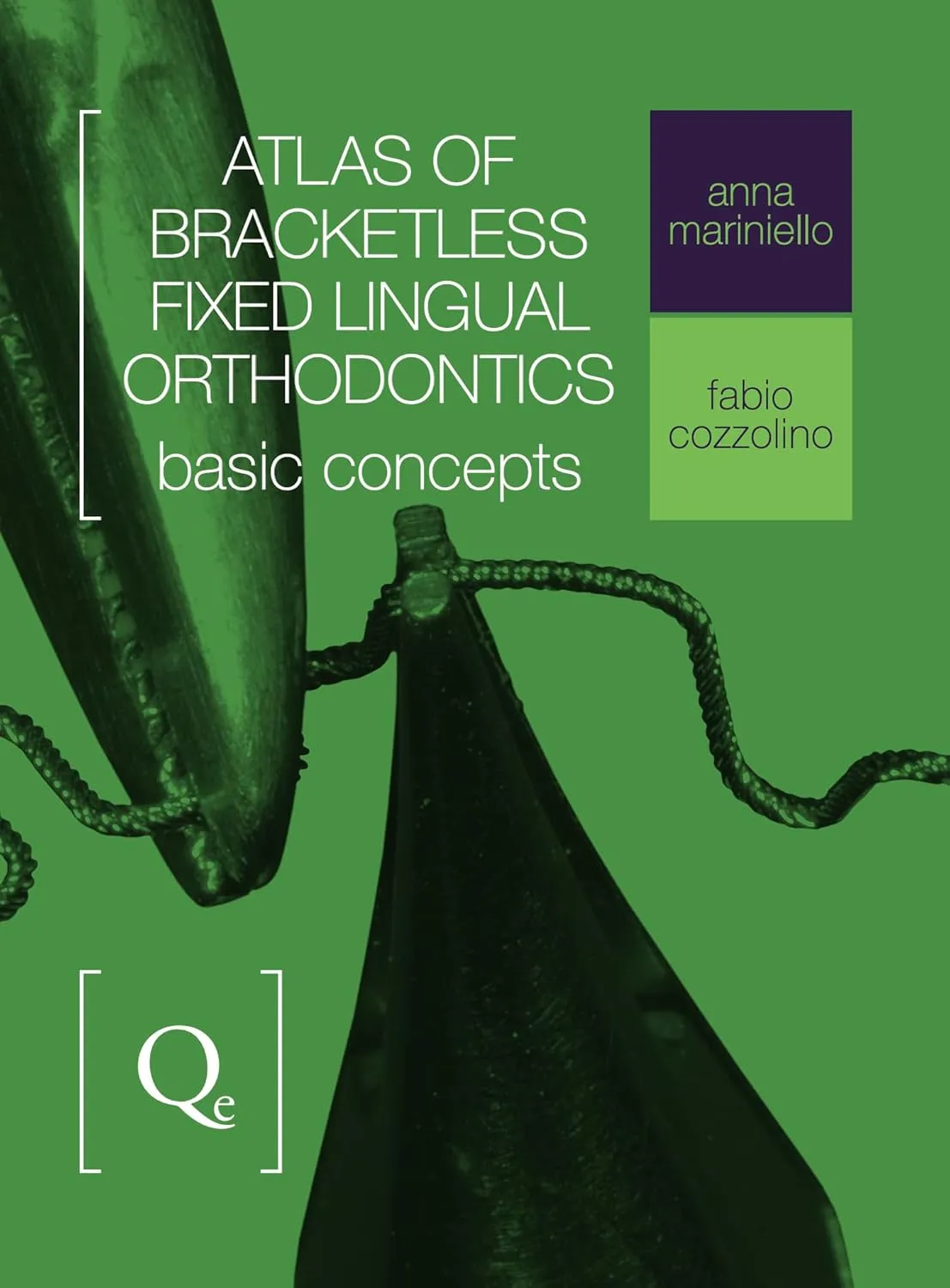Atlas of Bracketless Fixed Lingual Orthodontics Basic Concepts | Hardcover