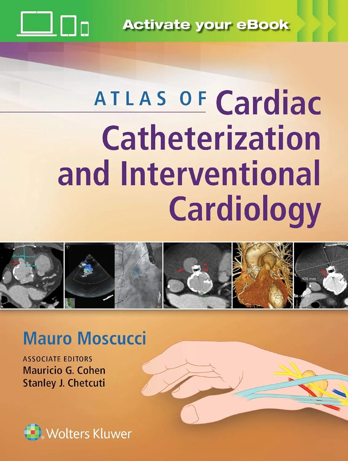 Atlas of Cardiac Catheterization and Interventional Cardiology | Hardcover