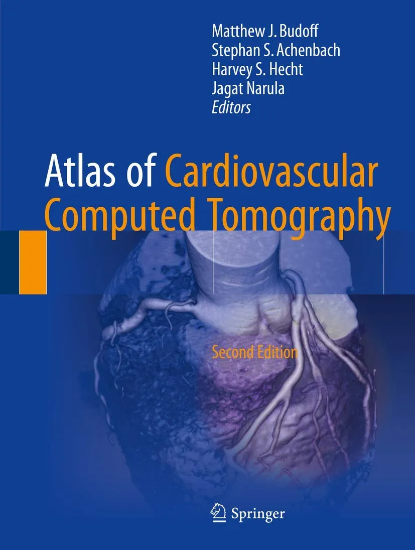 Atlas of Cardiovascular Computed Tomography | 2nd Edition | Hardcover