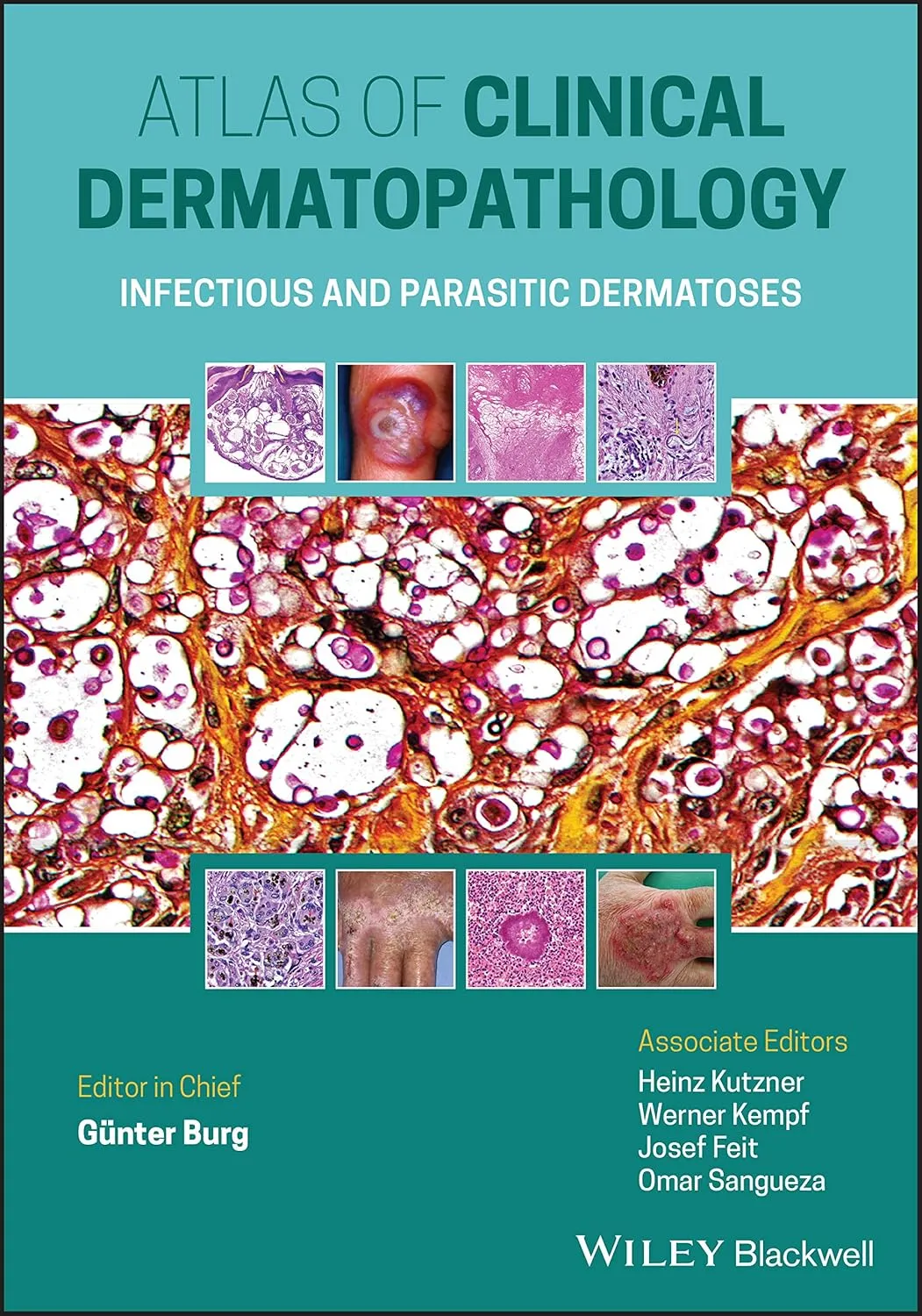 Atlas Of Clinical Dermatopathology Infectious And Parasitic Dermatoses | Hardcover