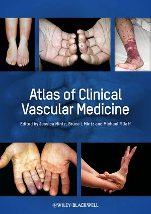 Atlas of Clinical Vascular Medicine | Hardcover