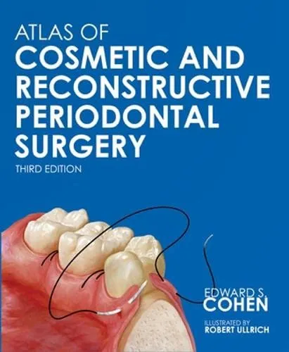 Atlas of Cosmetic and Reconstructive Periodontal Surgery | Third Edition With CD