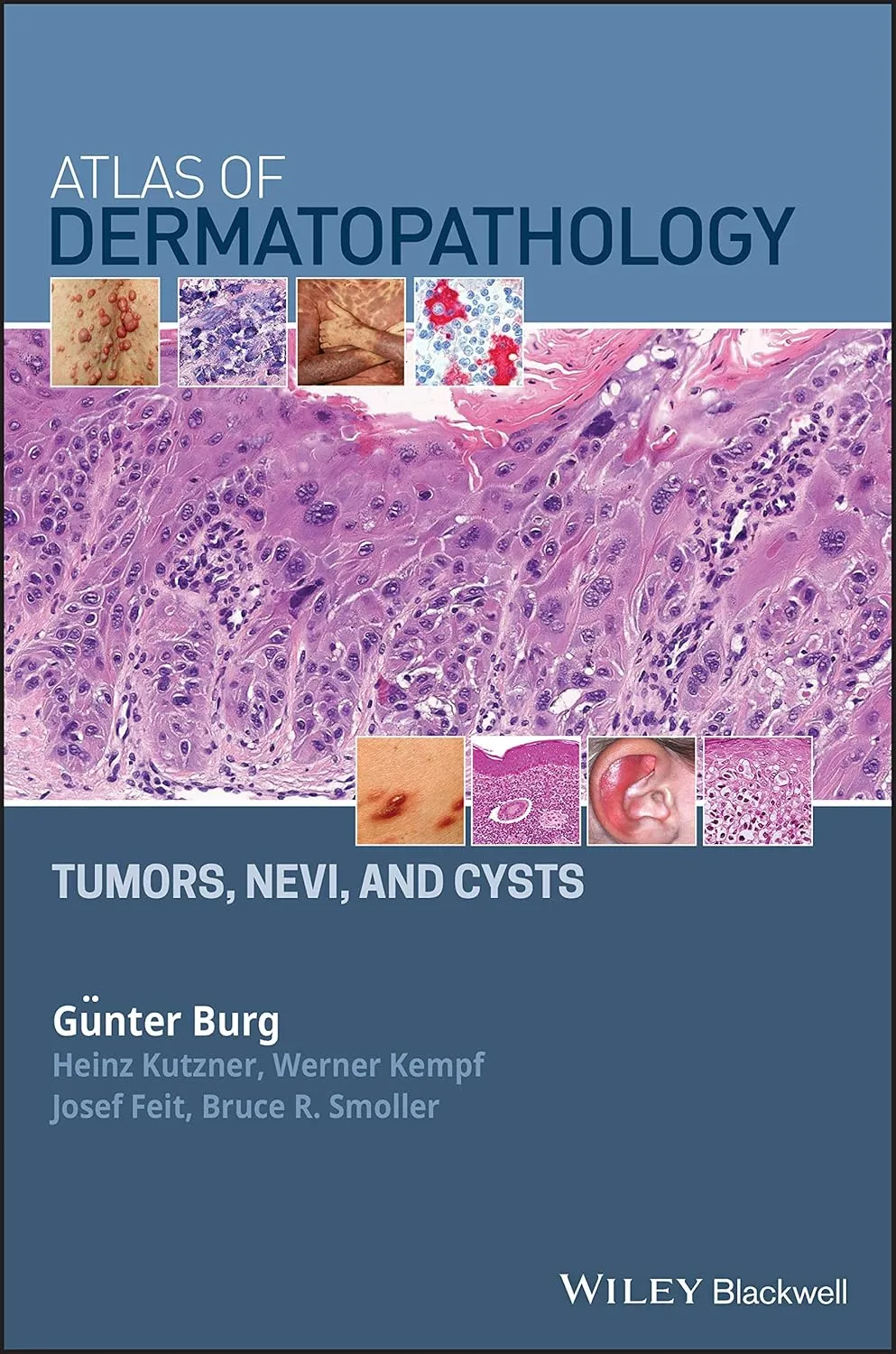 Atlas of Dermatopathology Tumors | Nevi | and Cysts | Hardcover