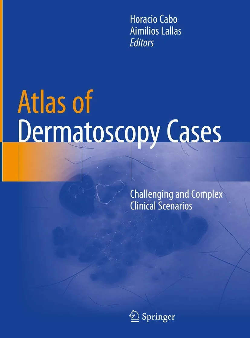 Atlas Of Dermatoscopy Cases Challenging And Complex Clinical Scenarios | Hardcover