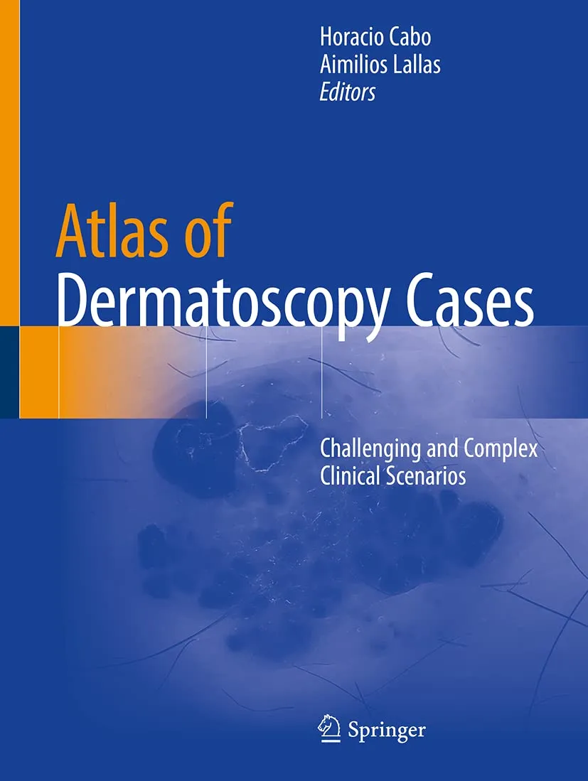 Atlas Of Dermatoscopy Cases Challenging And Complex Clinical Scenarios | Paperback
