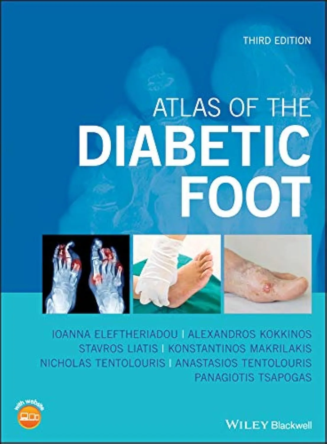 Atlas of the Diabetic Foot | Third Edition | Hardcover