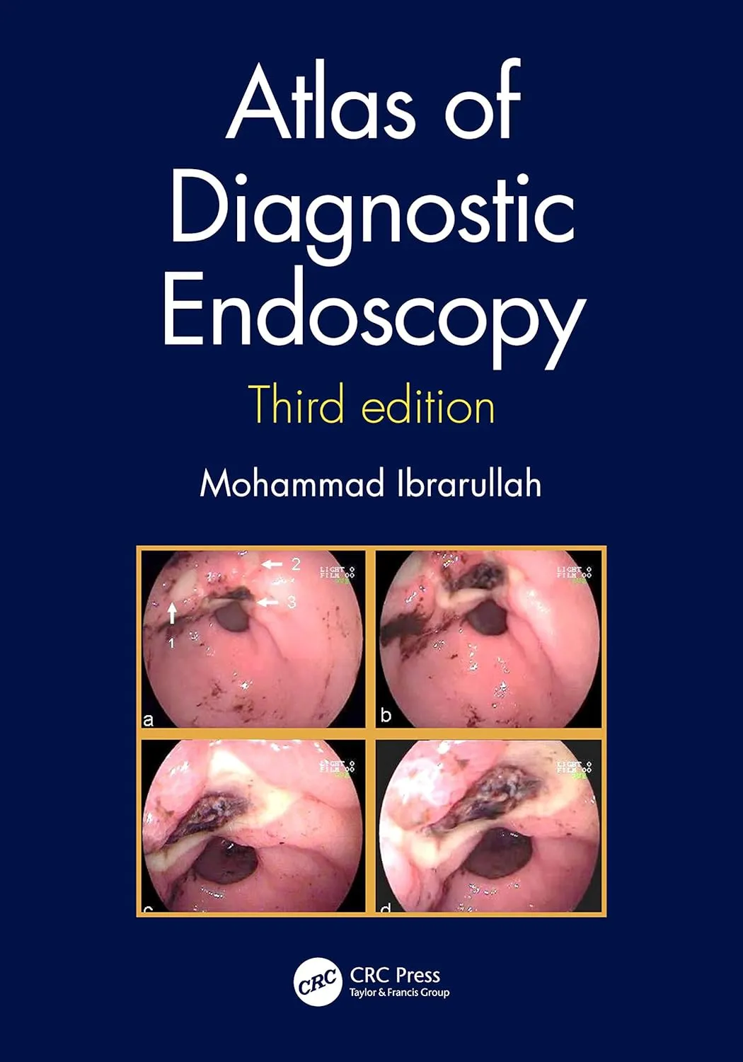 Atlas of Diagnostic Endoscopy | Third Edition | Hardcover
