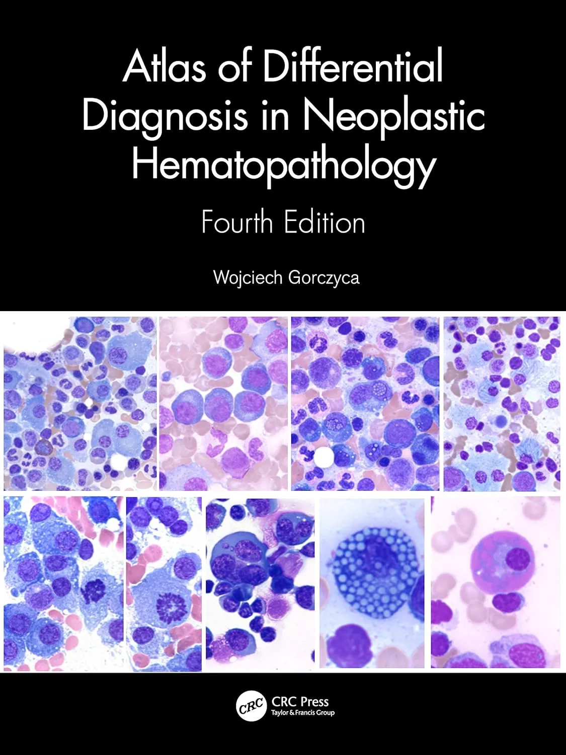 Atlas Of Differential Diagnosis In Neoplastic Hematopathology 4th Edition | Hardcover