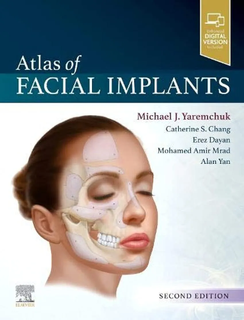 Atlas Of Facial Implants With Access Code 2nd Edition | Hardcover