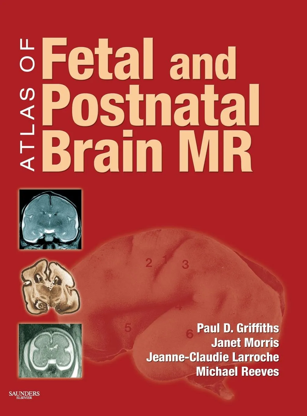 Atlas of Fetal and Postnatal Brain MR | Hardcover