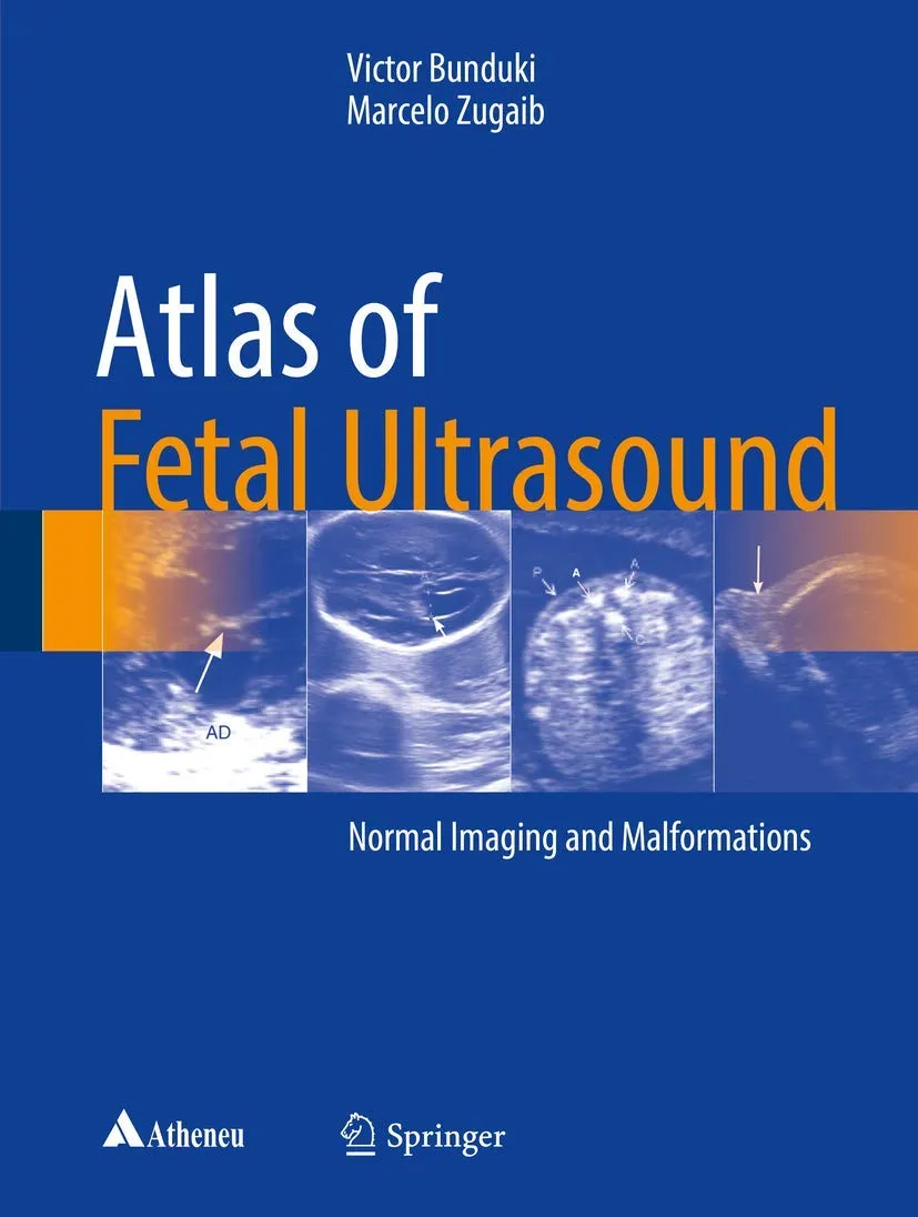 Atlas of Fetal Ultrasound | Hardcover