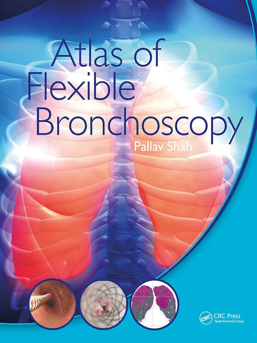 Atlas Of Flexible Bronchoscopy | Paperback