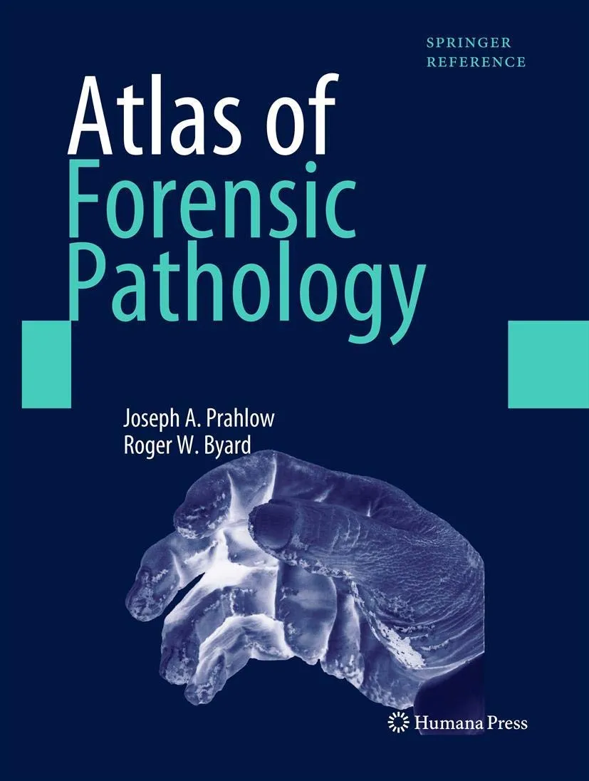 Atlas of Forensic Pathology | Hardcover