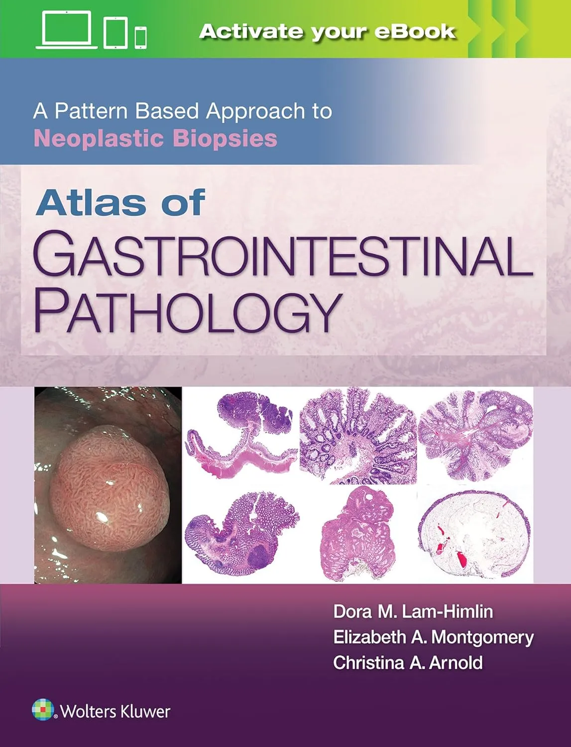 Atlas of Gastrointestinal Pathology A Pattern Based Approach to Neoplastic Biopsies | Hardcover