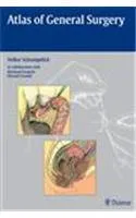 Atlas of General Surgery | Hardcover