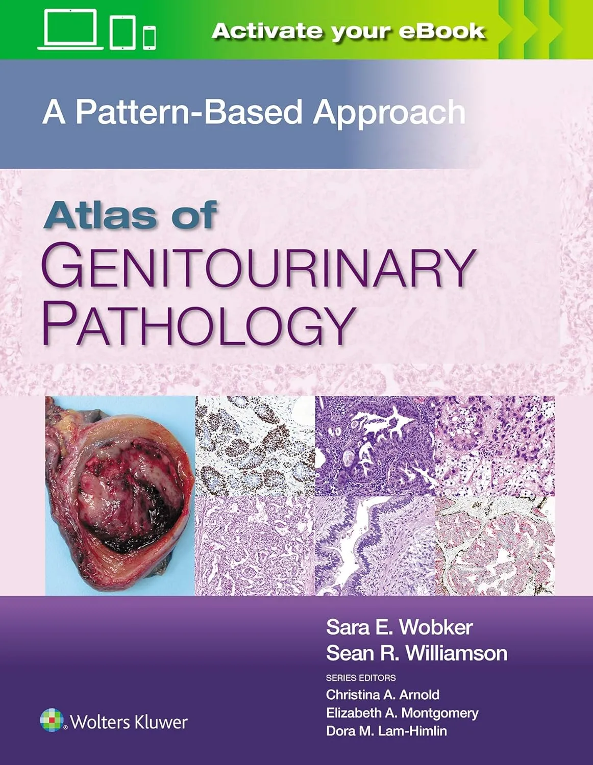 Atlas Of Genitourinary Pathology A Pattern Based Approach | Hardcover