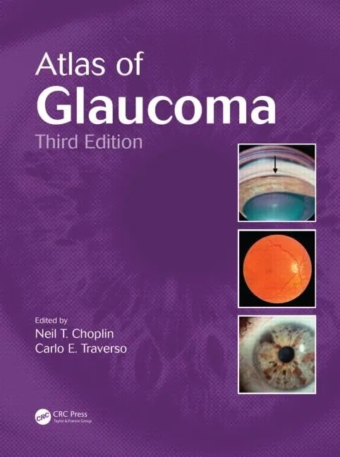 Atlas of Glaucoma | Third Edition | Hardcover