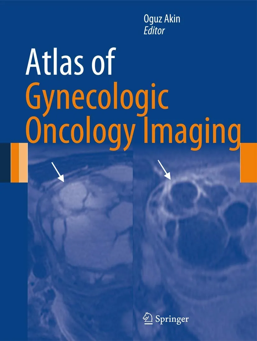 Atlas of Gynecologic Oncology Imaging | Hardcover