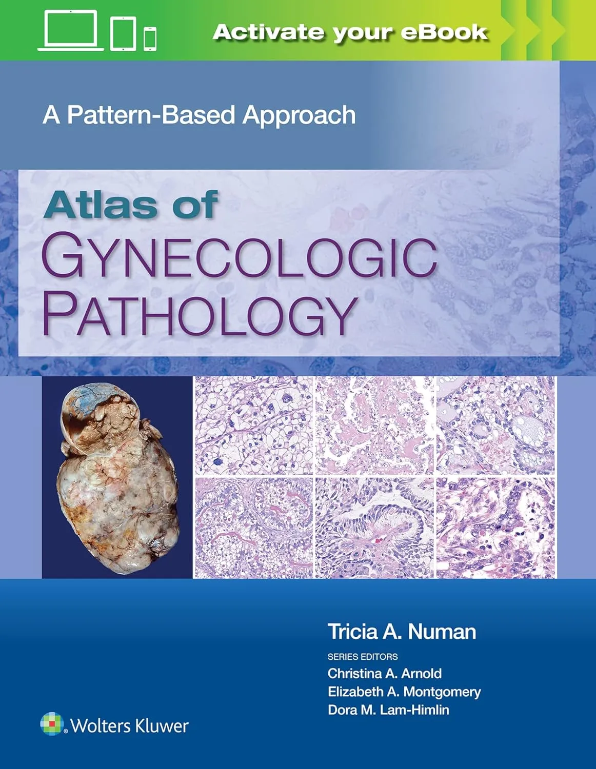 Atlas Of Gynecologic Pathology A Pattern Based Approach With Access Code | Hardcover