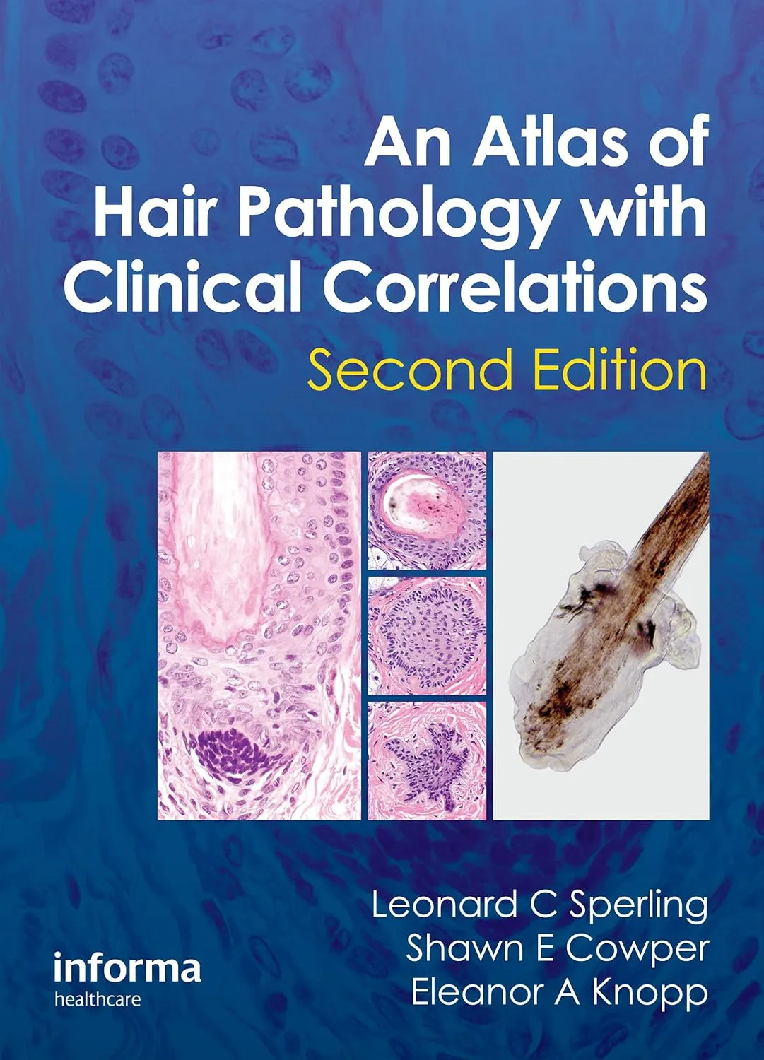 An Atlas of Hair Pathology with Clinical Correlations | 2nd Edition | Hardcover