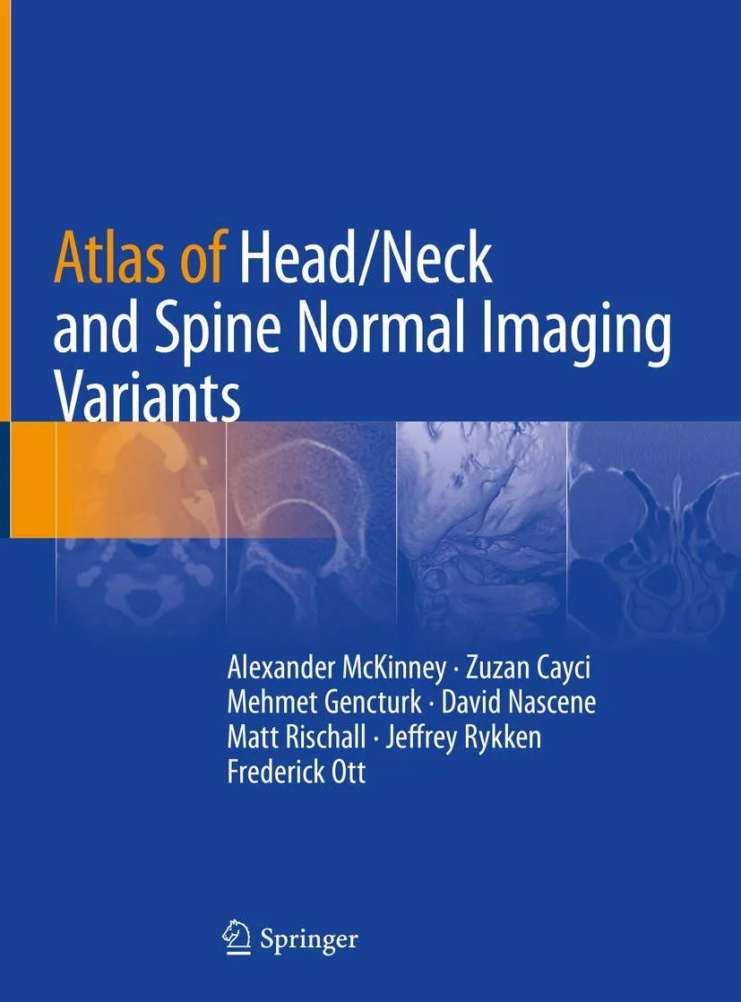 Atlas of Head/Neck and Spine Normal Imaging Variants | Hardcover